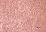 5 – Visione superficiale delle cellule corticali